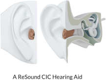 A ReSound CIC Hearing Aid
