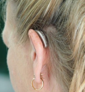 Woman wearing a hearing aid